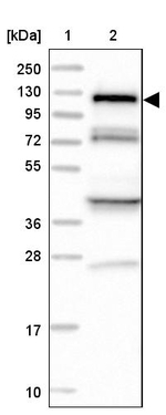 HIP1R Antibody in Western Blot (WB)