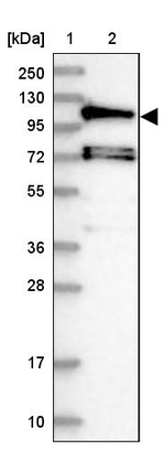 HIP1R Antibody in Western Blot (WB)