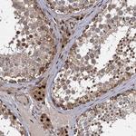 GAL3ST4 Polyclonal Antibody