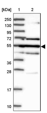 GAL3ST4 Antibody in Western Blot (WB)