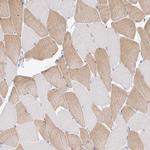 PLCD4 Polyclonal Antibody