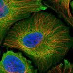 PLCD4 Polyclonal Antibody