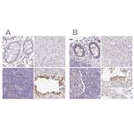 PLCD4 Antibody in Immunohistochemistry (IHC)