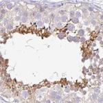 PLCD4 Antibody in Immunohistochemistry (IHC)