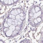 PLCD4 Antibody in Immunohistochemistry (IHC)