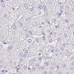 PLCD4 Antibody in Immunohistochemistry (IHC)