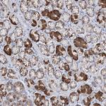 TRIM71 Antibody in Immunohistochemistry (Paraffin) (IHC (P))