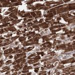 TRIM71 Antibody in Immunohistochemistry (Paraffin) (IHC (P))