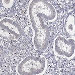 Connexin 31.1 Antibody in Immunohistochemistry (Paraffin) (IHC (P))