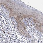 Connexin 31.1 Antibody in Immunohistochemistry (Paraffin) (IHC (P))