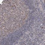 MRPL44 Antibody in Immunohistochemistry (Paraffin) (IHC (P))