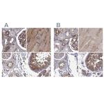 MAP4 Antibody in Immunohistochemistry (IHC)