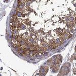 MAP4 Antibody in Immunohistochemistry (IHC)