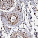 MAP4 Antibody in Immunohistochemistry (IHC)