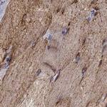 MAP4 Antibody in Immunohistochemistry (IHC)