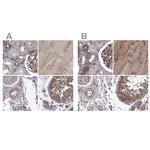 MAP4 Antibody in Immunohistochemistry (IHC)