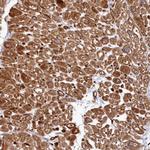 MAP4 Antibody in Immunohistochemistry (IHC)