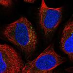 TBC1D23 Polyclonal Antibody