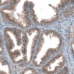 TBC1D23 Antibody in Immunohistochemistry (IHC)