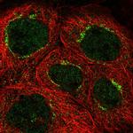 CEP83 Polyclonal Antibody