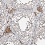 RASSF8 Antibody in Immunohistochemistry (Paraffin) (IHC (P))