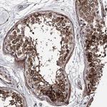 CWF19L2 Antibody in Immunohistochemistry (Paraffin) (IHC (P))