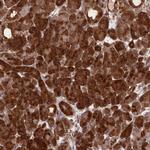 CCDC91 Antibody in Immunohistochemistry (Paraffin) (IHC (P))
