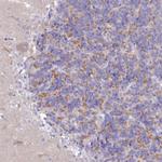 VPS26B Polyclonal Antibody