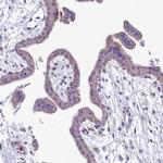 VPS26B Antibody in Immunohistochemistry (Paraffin) (IHC (P))
