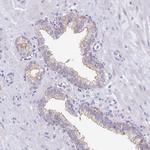 VPS26B Antibody in Immunohistochemistry (Paraffin) (IHC (P))