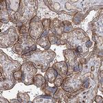 ZFYVE28 Polyclonal Antibody