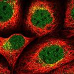 SEC24B Polyclonal Antibody