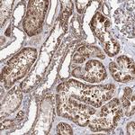 SEC24B Antibody in Immunohistochemistry (Paraffin) (IHC (P))