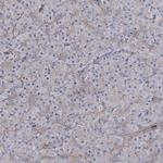 SEC24B Antibody in Immunohistochemistry (Paraffin) (IHC (P))