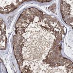 SEC24B Antibody in Immunohistochemistry (Paraffin) (IHC (P))