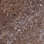 SEC24B Antibody in Immunohistochemistry (Paraffin) (IHC (P))
