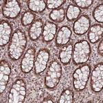 FAM204A Antibody in Immunohistochemistry (IHC)