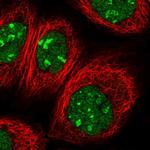 PTMS Polyclonal Antibody