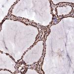 PTMS Antibody in Immunohistochemistry (Paraffin) (IHC (P))