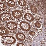 NPRL2 Antibody in Immunohistochemistry (Paraffin) (IHC (P))