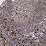 WDR75 Antibody in Immunohistochemistry (Paraffin) (IHC (P))