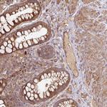 SIK1 Antibody in Immunohistochemistry (Paraffin) (IHC (P))