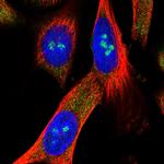 METL5 Polyclonal Antibody