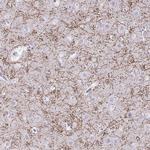 CREG2 Polyclonal Antibody
