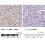 CREG2 Antibody in Immunohistochemistry (IHC)