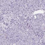CREG2 Antibody in Immunohistochemistry (IHC)
