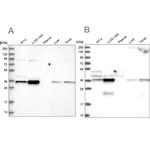 GPATCH11 Antibody in Western Blot (WB)