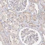 GPATCH11 Antibody in Immunohistochemistry (Paraffin) (IHC (P))