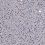 GPATCH11 Antibody in Immunohistochemistry (Paraffin) (IHC (P))