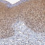 GPATCH11 Antibody in Immunohistochemistry (Paraffin) (IHC (P))
